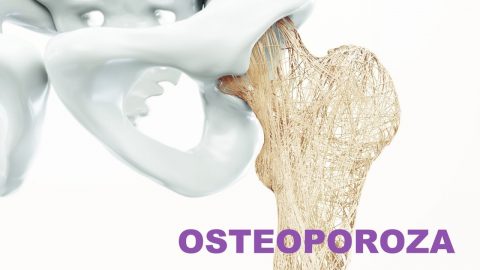 cum se tratează osteoporoza cu artrita)